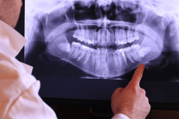 Best Weekend Emergency Dentist in West Orange, TX